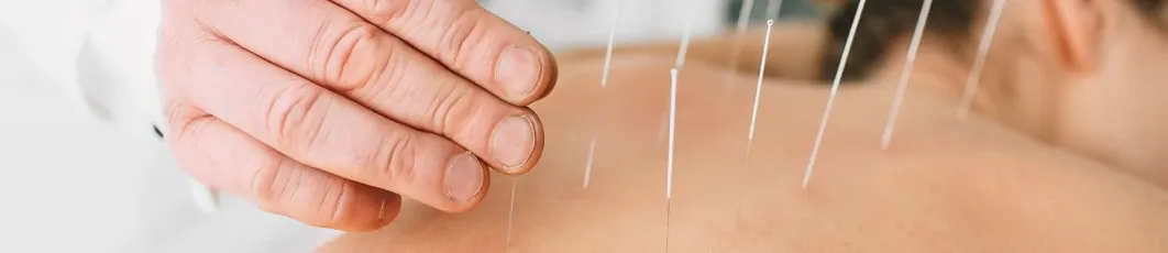 Maestría en Estudios Biológico-Naturistas especializado en Acupuntura o Fitoterapia Tradicional China